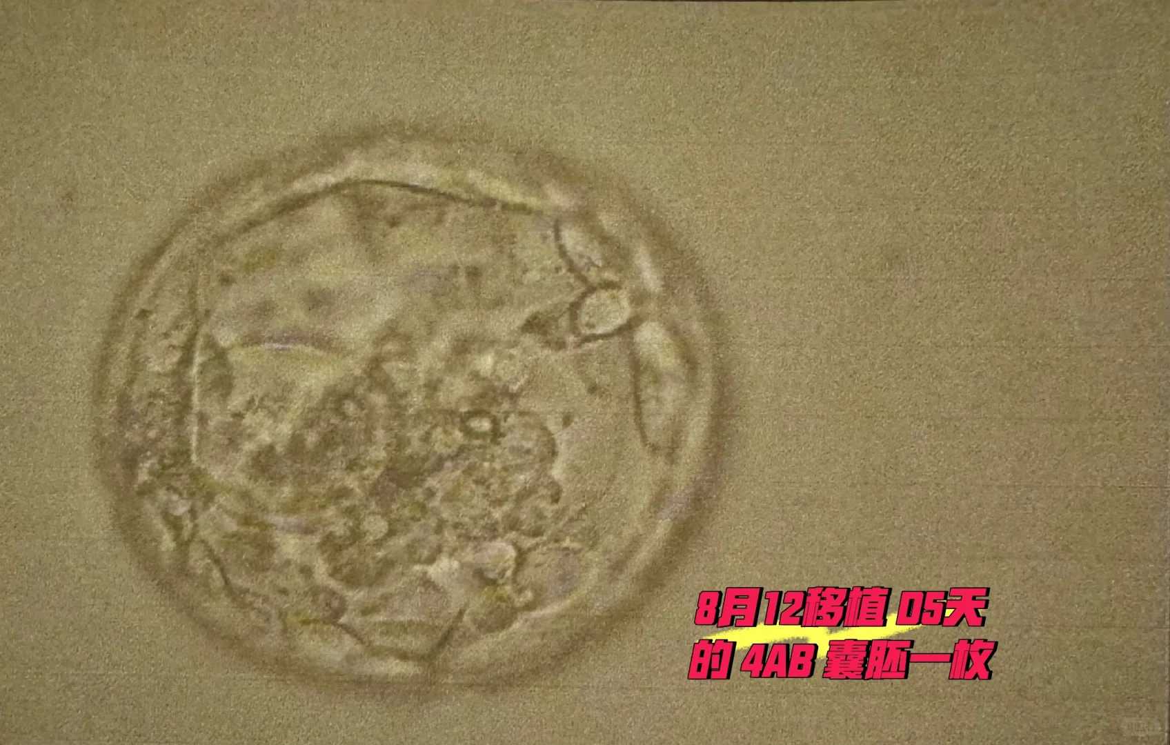 怀孕期间困倦容易发生于哪个孕期？什么因素可能加？