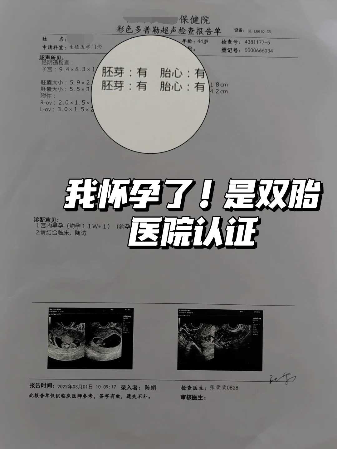 天津试管代怀诊所排行,做泰国试管婴儿的步骤、流程是什么？_做完B超医生说宝